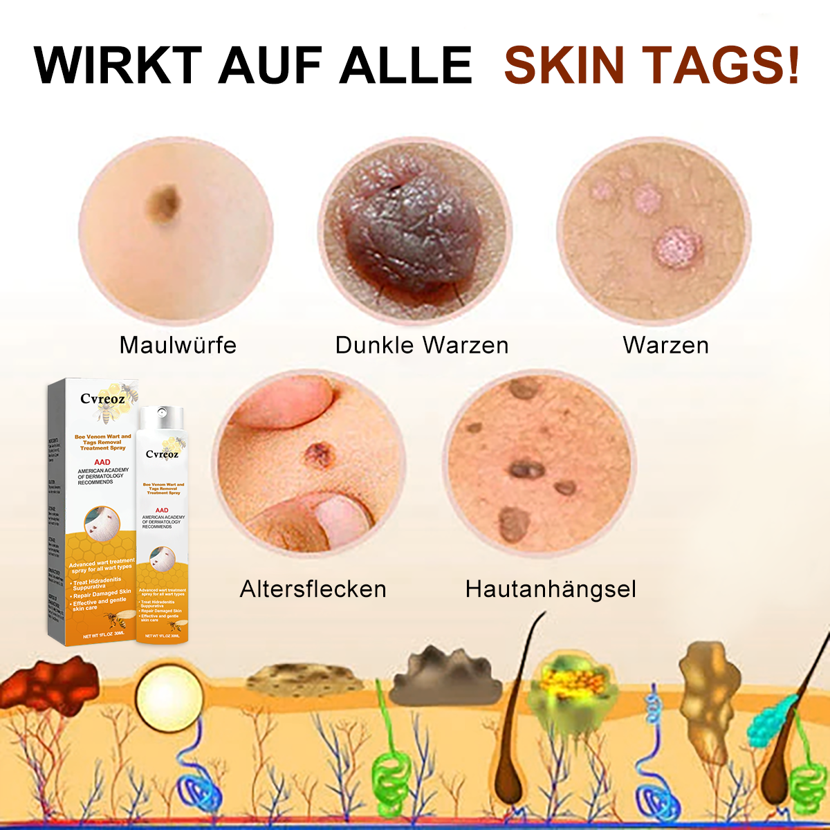 Wart Away Pro – 1+1 Gratis – nicht-invasive Behandlung – natürliche Kraft des Bienengifts – schnell und effektiv – Wanduhr